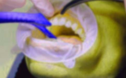 第一次拔牙作文(合集15篇)